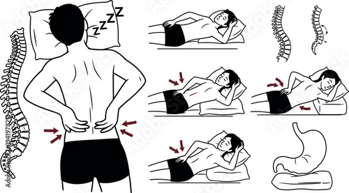 Detailed medical illustration showing ideal and problematic sleeping positions for preventing back pain and improving overall spinal health