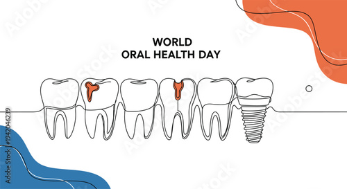 Row of human teeth showing healthy, decayed, and dental implant versions for World Oral Health Day medical awareness concept drawing.
