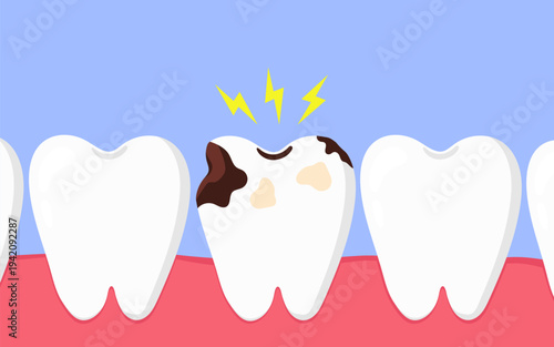 Tooth decay and dental caries concept. Damaged tooth with toothache. Vector illustration on white