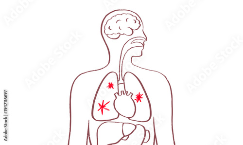 Lung disease concept