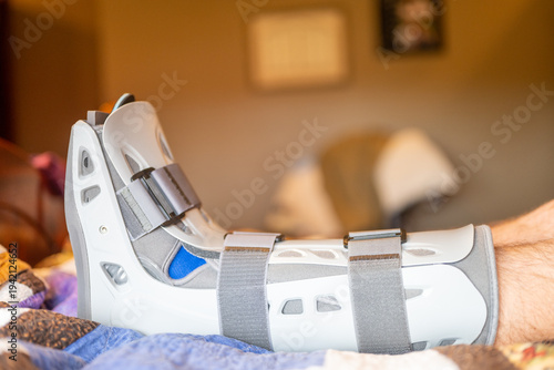 Cuadro en lienzo Foot in a medical boot rests on a bed with blankets during recovery at home afte