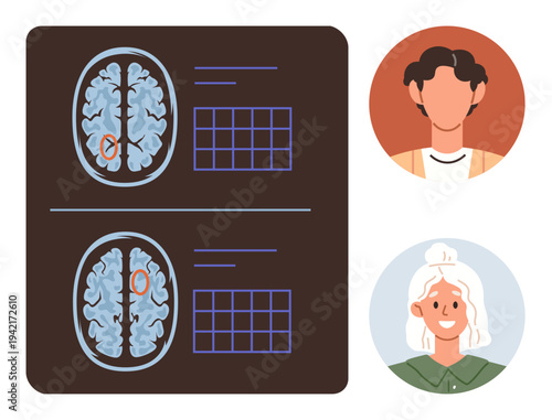 Medical research, neurology, memory loss, brain scans, aging, and healthcare. Brain MRI comparison surrounded by portraits of a younger and older person. Medical research and neurology concept