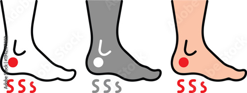 Minimalist foot arch types diagram showing flat foot, normal arch and high arch medical podiatry vector illustration