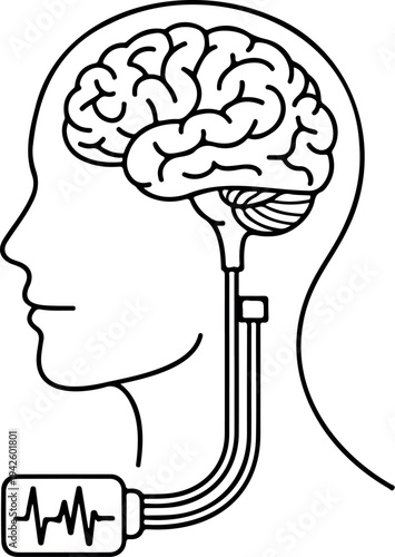 Minimalist line art of human head profile showing brain with medical implant device and deep brain stimulation wires