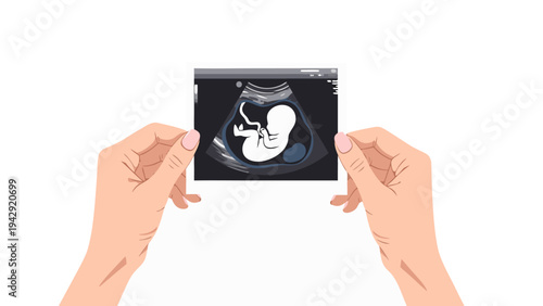 Vector illustration of human hands holding a medical ultrasound scan, visualizing a developing fetus; a concept for early pregnancy and prenatal healthcare