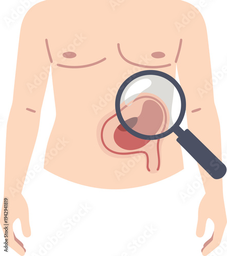Medical illustration of a male abdomen highlighting a bulging hernia area, with a magnifying glass zooming in on the weakened abdominal wall to show the internal protrusion in detail
