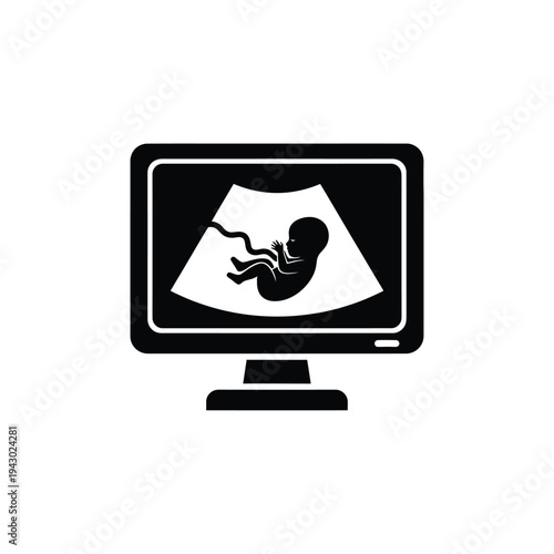 Ultrasound monitor displaying a fetal image.
