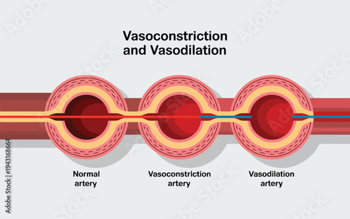 A detailed medical diagram illustrates the normal state, vasoconstriction, and vasodilation of arteries