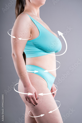 Unrecognizable curvy woman in underwear with arrows on fat body, concept of full body liposuction, plastic surgery, lifting and body contouring