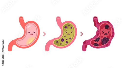 Digestive Health Stages From Healthy Stomach to Discomfort and Potential Issues