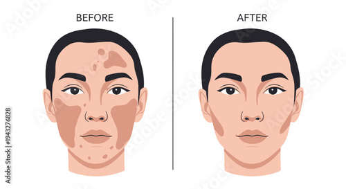 Face comparison illustration showing condition improvement