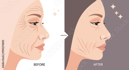 Facial rejuvenation comparison before and after illustration anti aging concept