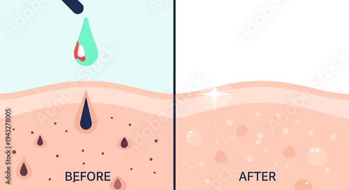 Skin treatment concept before and after