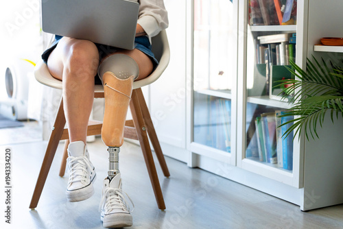 Young woman with prosthetic leg working on laptop, embracing accessibility technology