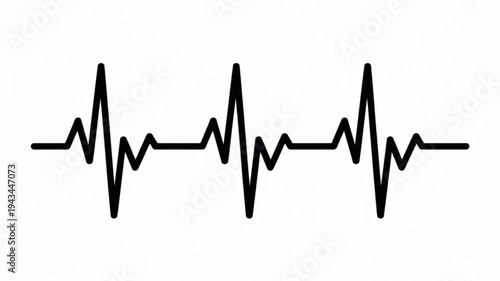 Close-up view of a black ECG waveform centered on a plain white background, illustrating heart activity in a clinical illustration