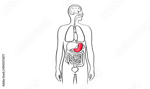 Gastroesophageal reflux pain