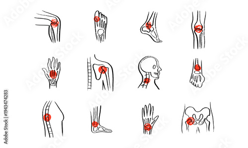 Arthritis Sketch Poster