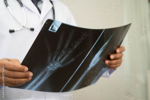 Photography Doctor examining hand ankle joint bone radiography xray film.