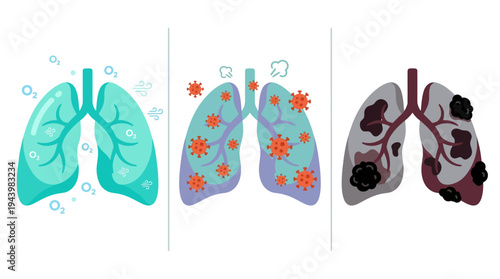 A clear visual progression illustrating the stages of human lung health, from healthy and oxygenated to lungs affected by infection and ultimately severe damage