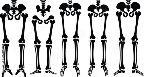 Detailed human lower skeleton silhouettes with pelvic bone variations, femur tibia fibula structures, anatomical medical vector illustration for educational comparison