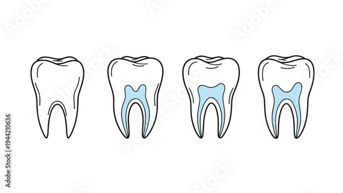 Educational diagram showing four cross sections of a human tooth illustrating the internal structure, root, and enamel.