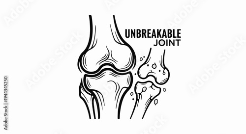 Black and white illustration of a knee joint labeled "Unbreakable Joint.