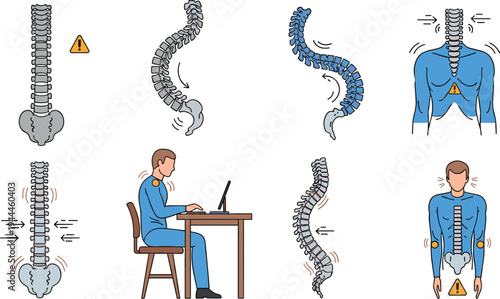 Human spine problems and back pain concept set with curved spine, scoliosis, poor posture at desk, and medical anatomy illustration
