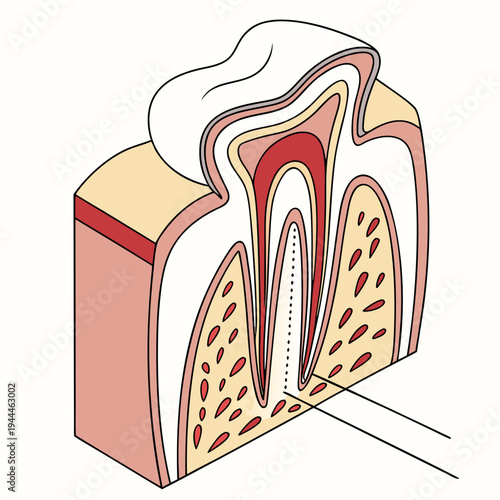 A cross-section of a tooth showing its internal anatomy