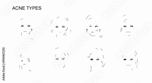Minimalist line drawings of faces, illustrating various skin conditions and expressions