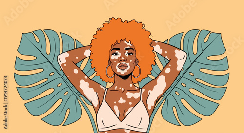 Beautiful Black Woman with Vitiligo and Orange Afro Hair in Bra Top, Posing with Tropical Monstera Leaves on a Yellow Background Vector Illustration