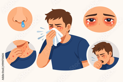 Sick Man Sneezing into Tissue with Allergy Symptoms Icons Including Runny Nose, Red Watery Sore Eyes, Itchy Skin Rash, and Coughing, Healthcare and Medical Concept Flat Vector Illustration Design