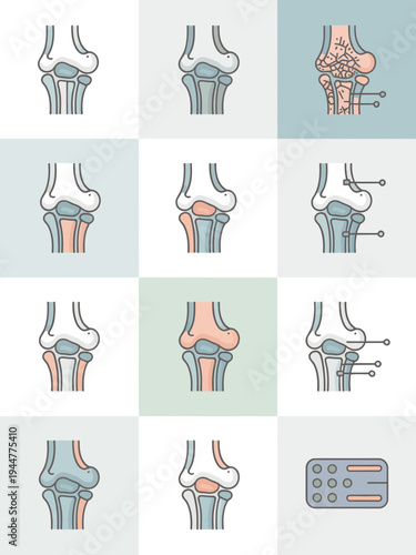 Orthopedic Medical Icons for Joint Pain Injury and Treatment