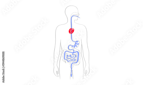 Esophagus pain diagram