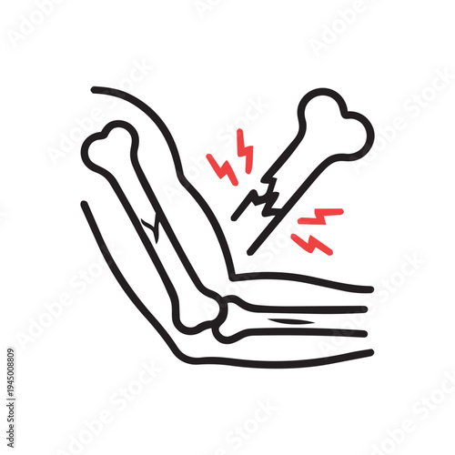 Elbow fracture bone injury line icon. Orthopedic trauma vector illustration isolated on white background.