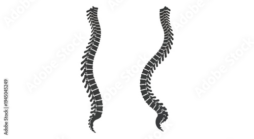 A comparative view of two human spines one healthy and one with scoliosis as a silhouette