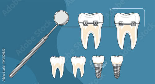 Medical dental illustrations showing various teeth conditions and treatments including braces implants and a dental mirror.