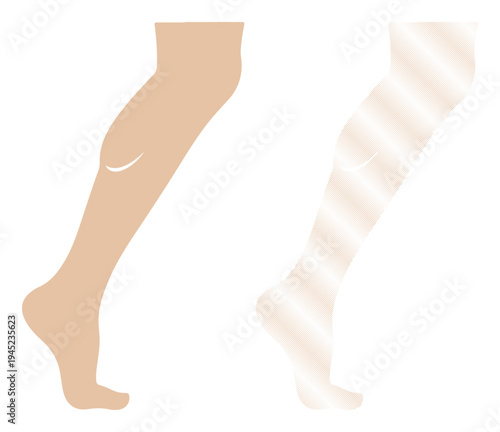 Close-up of a woman's leg showing healthy skin and a varicose vein comparison