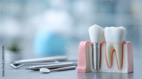 Model of dental implant beside natural tooth with dental mirror and explorer, representing implant placement and restorative dentistry procedure.