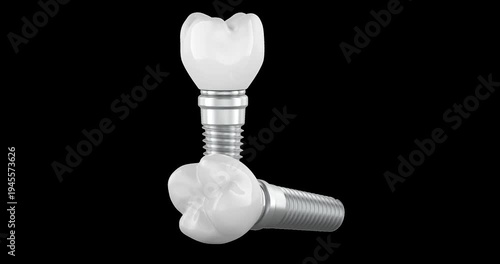 Two dental implants with ceramic crowns rotation animation seamlessly loopable. 3D rendering isolated on transparent background