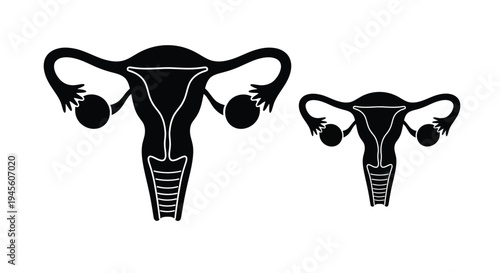 Female reproductive systems larger and smaller depicted in black silhouette