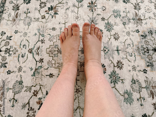 Legs with swelling. Swelling during pregnancy