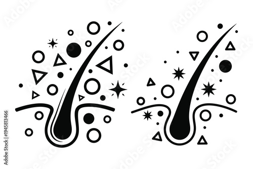 Black and white illustration of two hair follicles with various shapes