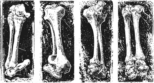 Vintage human femur bone illustrations set anatomical skeletal system drawing medical retro black and white