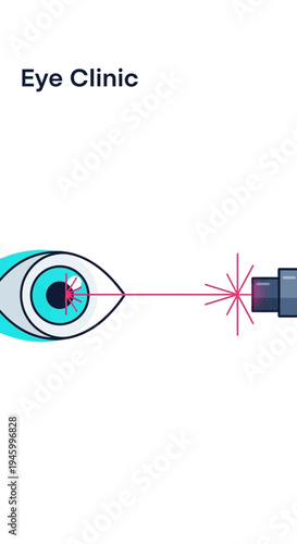 Innovative Eye Care Illustration Depicting Laser Vision Correction Technology and Ophthalmological