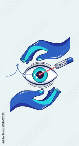 Innovative Illustration Depicting Laser Eye Surgery Procedure With Symbolic Representation and
