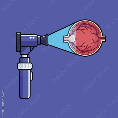 Medical Examination of Eye Retina Using Ophthalmoscope with Detailed Anatomical Display