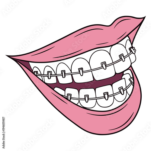 A false jaw, or dental prosthetic, replaces missing teeth, restoring function and appearance, crafted to fit comfortably and support natural chewing and smiling.
