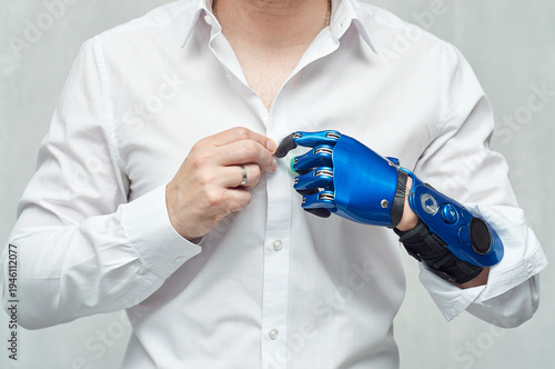 Cuadro en lienzo Close-up of man with bionic prosthetic arm buttoning up a white shirt, artificia