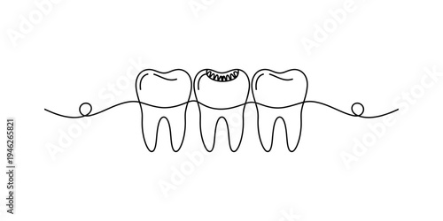 Continuous line drawing of three human teeth with one showing signs of dental decay or cavity. Vector, illustration