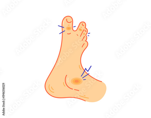Illustration of pain in the joints of the toes and ankles. Arthritis and inflammation. Joint diseases and health problems. Flat style illustration with outline. White background.